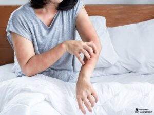 Plano, TX homeowner with red, itchy bed bug bites on arms sitting on bed – Preferred Pest Management
